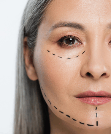 servicos-ritidoplastia-xpert